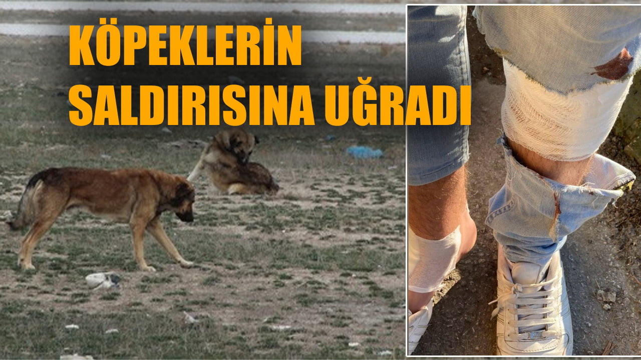 Karabük’te başı boş köpek dehşeti bitmiyor. Mesleki eğitim öğrencisi, köpeklerin saldırısına uğrayarak yaralandı.